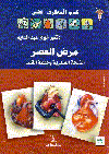 مرض العصر